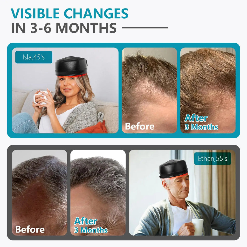 Wireless LLLT Laser Cap for Hair Growth&Against Hair Loss 660nm&850nm Red Light Therapy Cap for Seborrheic Alopecia&Damaged Hair